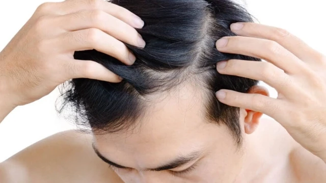 bai-viet/cach-moc-toc-nhanh-cho-nam-an-toan-nhung-hieu-qua.html