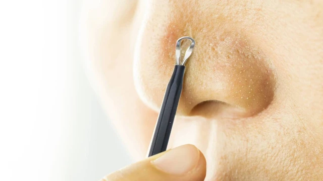 bai-viet/cach-nan-mun-bang-cay-nan-mun-ma-ban-nen-biet.html