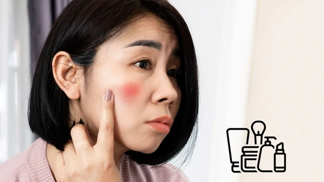 bai-viet/da-bi-kich-ung-my-pham-nhan-biet-the-nao-va-cach-cai-thien-ra-sao.html