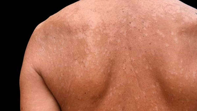 bai-viet/cach-nhan-biet-mot-so-hinh-anh-lang-ben-nau-den-trang-53066.html