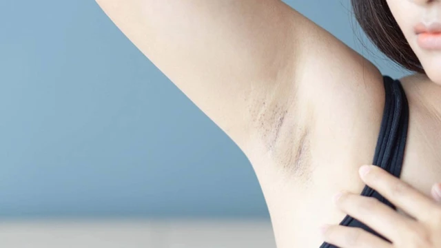 bai-viet/cach-nho-long-nach-khong-can-nhip-don-gian-tai-nha-64550.html