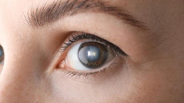 bai-viet/cach-phong-ngua-duc-thuy-tinh-the-giai-phap-bao-ve-doi-mat-khoe-manh.html