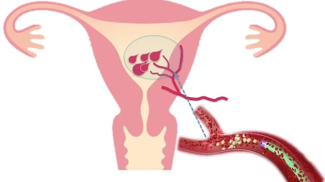 bai-viet/cach-tong-san-dich-sau-sinh-mo-nhanh-chong-cho-thai-phu.html