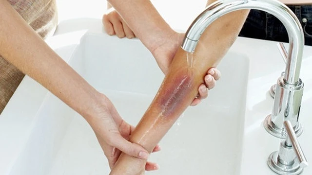 bai-viet/cach-tri-bong-bo-xe-may-cho-tre-em-don-gian-nhanh-lanh.html