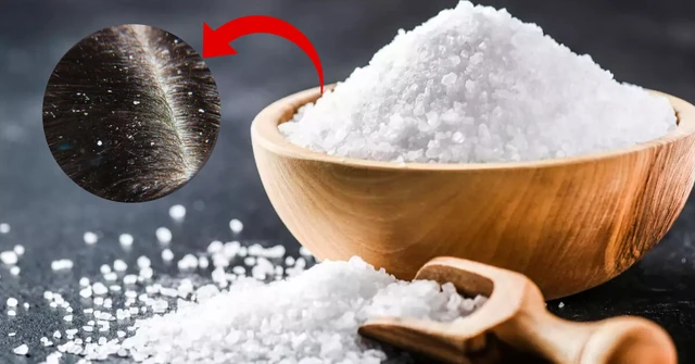 bai-viet/cach-tri-gau-bang-muoi-don-gian-ma-hieu-qua-khong-ngo-58589.html