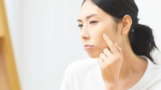 bai-viet/cach-tri-nam-chan-dinh-tai-nha-va-nhung-dieu-can-chu-y.html