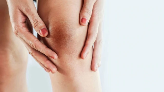 bai-viet/cach-tri-tham-dau-goi-tai-nha-don-gian-hieu-qua-moi-nguoi-nen-biet.html