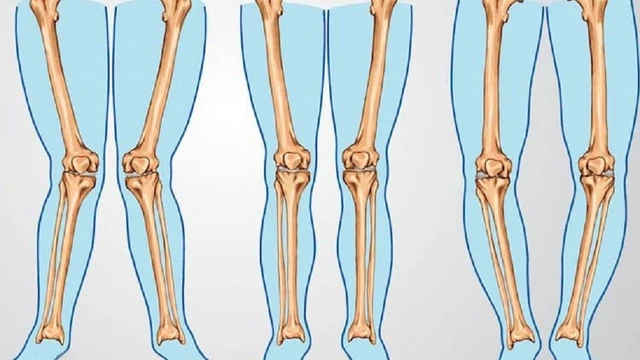 bai-viet/cai-thien-tinh-trang-chan-cong-ra-sau-bang-cach-nao.html