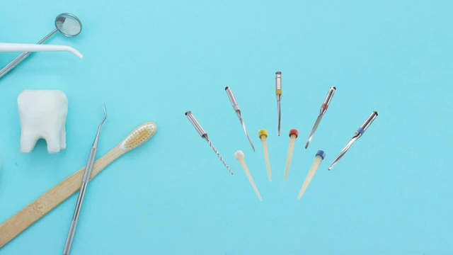 bai-viet/cam-chot-rang-la-gi-va-tai-sao-lai-can-thiet-sau-khi-dieu-tri-tuy.html