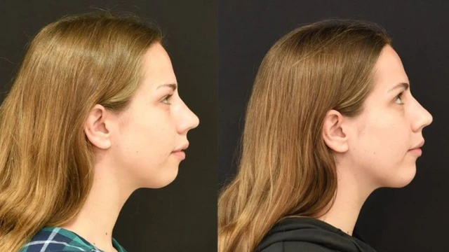 bai-viet/cam-lem-nguyen-nhan-dau-hieu-nhan-biet-va-cach-khac-phuc.html