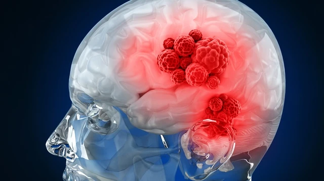 bai-viet/can-theo-doi-sau-dieu-tri-u-te-bao-mam-o-tre-em-nhu-the-nao-62029.html