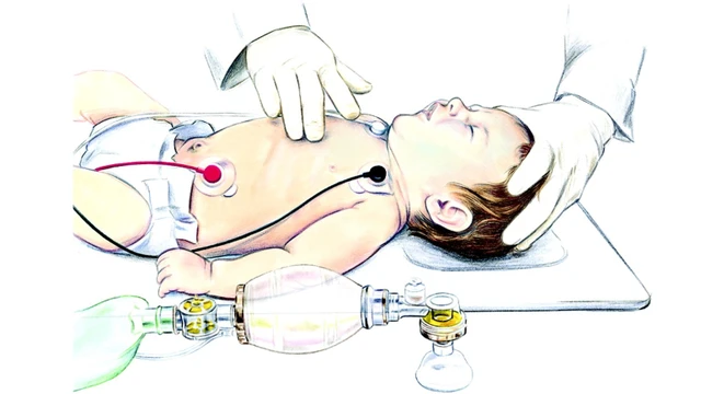 bai-viet/huong-dan-so-cap-cuu-ngung-tim-ngung-tho-o-tre-em.html