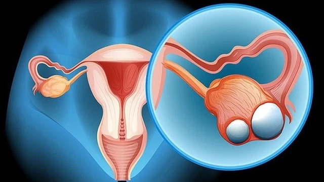 bai-viet/cat-1-ben-buong-trung-co-con-duoc-khong-chi-em-can-biet-66243.html