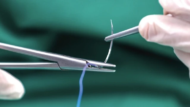 bai-viet/cat-chi-vet-thuong-co-dau-khong-bao-lau-thi-cat-duoc-59217.html