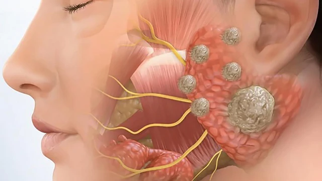 bai-viet/cat-tuyen-mang-tai-co-gay-nguy-hiem-cho-day-than-kinh-so-vii-khong.html