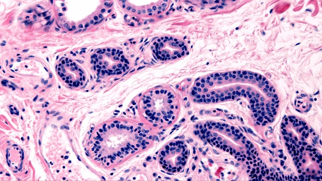 bai-viet/tuyen-mo-hoi-duoi-da-cau-tao-chuc-nang-va-mot-so-benh-ly-lien-quan.html