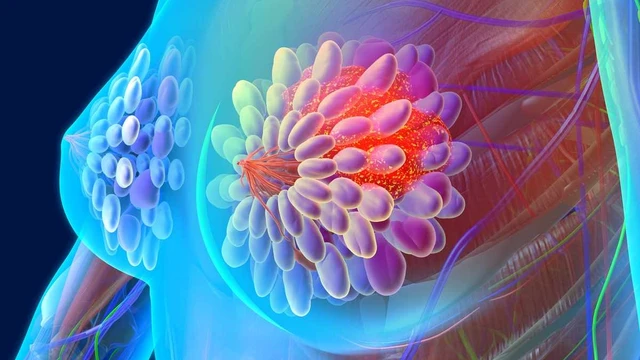 bai-viet/cau-tao-cua-vu-va-nhung-luu-y-ve-vu-khong-phai-ai-cung-hieu-ro.html