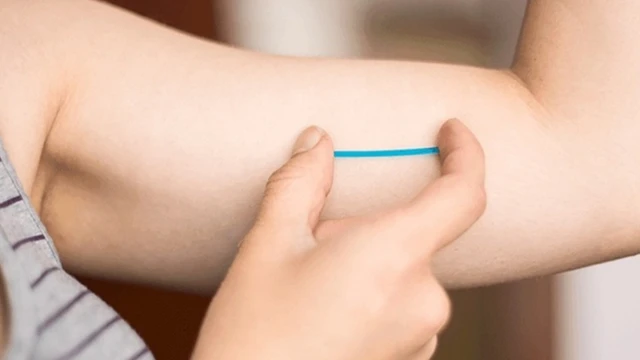 bai-viet/cay-que-tranh-thai-co-de-lai-seo-khong-nhung-luu-y-khi-cay-que-tranh-thai.html