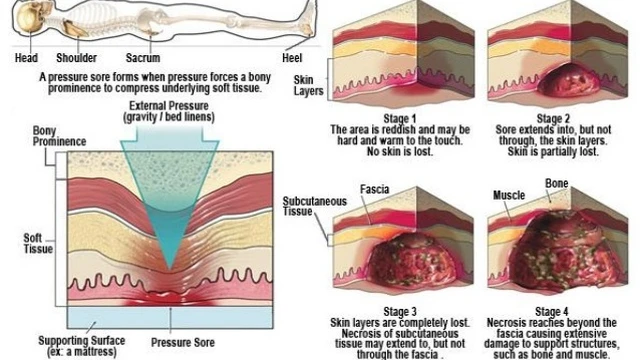bai-viet/cham-soc-suc-khoe-thuoc-boi-loet-ty-de-59419.html
