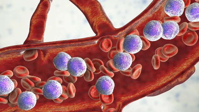 bai-viet/chan-doan-benh-bach-cau-cap-dong-lympho-o-tre-em-nhu-the-nao-61937.html