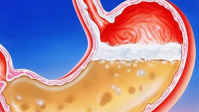 bai-viet/chat-nhay-trong-dich-vi-co-tac-dung-gi-ban-da-biet-chua-62321.html