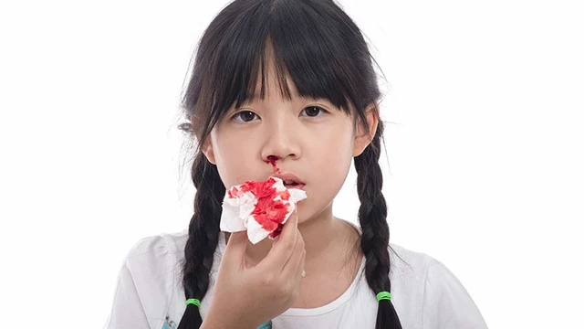 bai-viet/chay-mau-mui-nen-lam-gi-nguyen-nhan-chay-mau-mui-do-dau.html