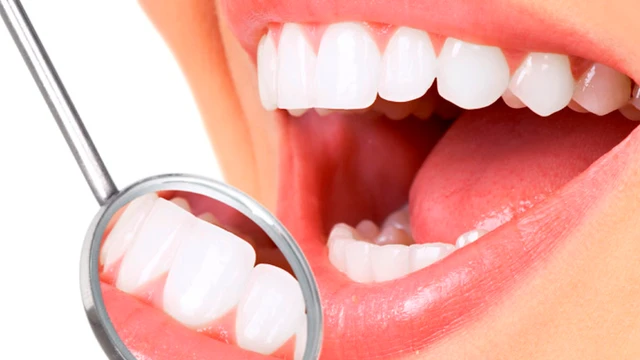 bai-viet/chi-phi-boc-rang-su-cho-rang-ho-nhu-the-nao.html