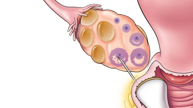 bai-viet/giai-dap-thac-mac-chi-phi-choc-hut-trung-het-bao-nhieu-tien.html