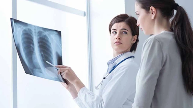 bai-viet/chi-phi-hoa-tri-ung-thu-phoi-co-ton-kem-khong-52046.html