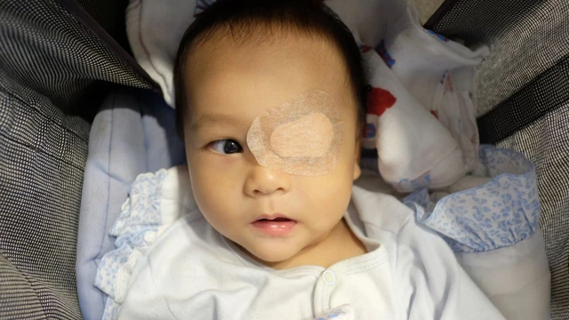 bai-viet/chi-phi-phau-thuat-chinh-mat-le-va-nhung-dieu-can-biet-truoc-khi-thuc-hien.html