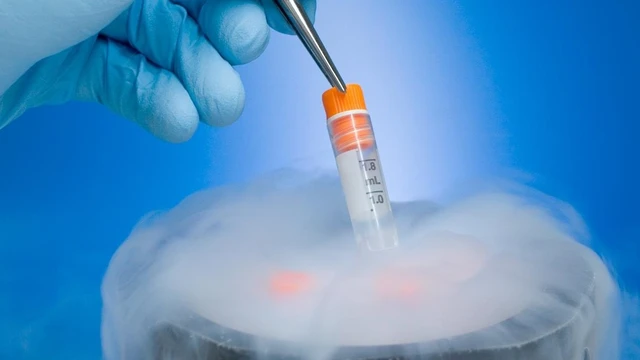 bai-viet/chi-phi-tru-dong-trung-la-bao-nhieu.html