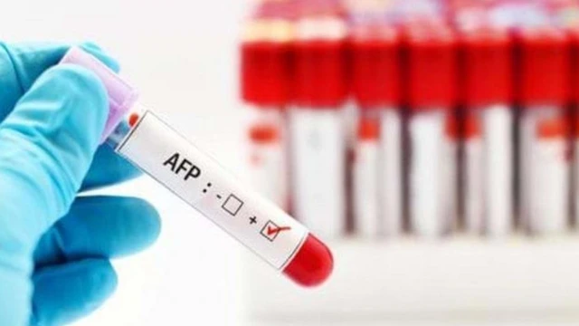 bai-viet/chi-so-afp-trong-mau-bao-nhieu-la-binh-thuong-doi-voi-chung-ta.html
