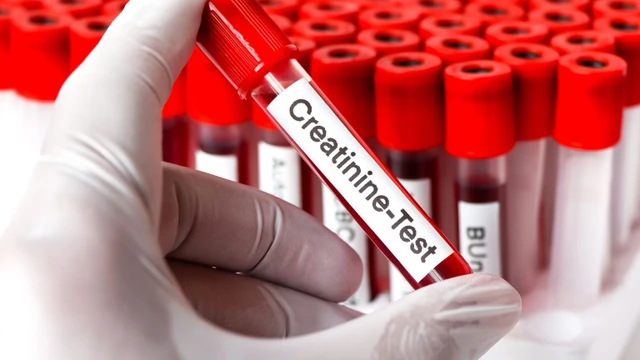 bai-viet/chi-so-albumin-creatinin-phan-anh-dieu-gi-ve-suc-khoe-than-cua-ban.html