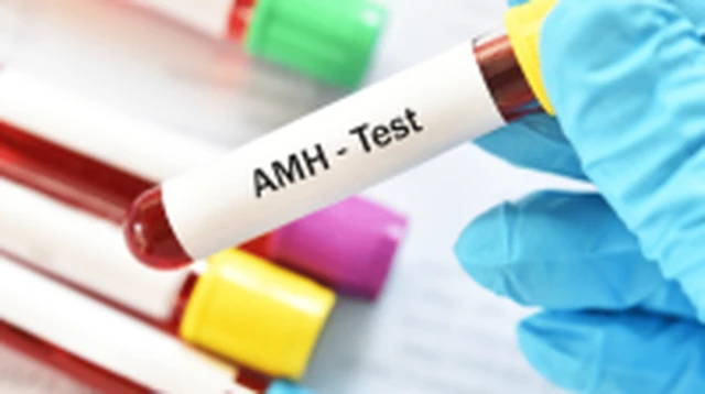 bai-viet/chi-so-amh-la-gi-xet-nghiem-amh-o-dau.html