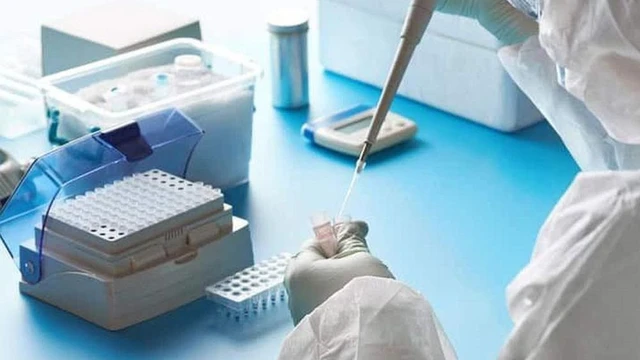 bai-viet/chi-so-ct-bao-nhieu-la-am-tinh-tim-hieu-cac-van-de-xoay-quanh-chi-so-ct.html