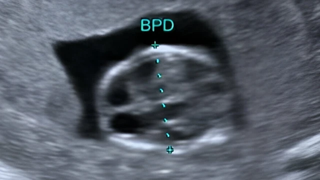 bai-viet/chi-so-duong-kinh-luong-dinh-thai-36-tuan-nhu-the-nao-la-binh-thuong.html