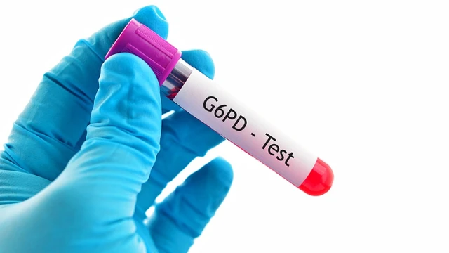 bai-viet/chi-so-g6pd-bao-nhieu-la-binh-thuong-giai-dap-ve-chi-so-g6pd-72491.html