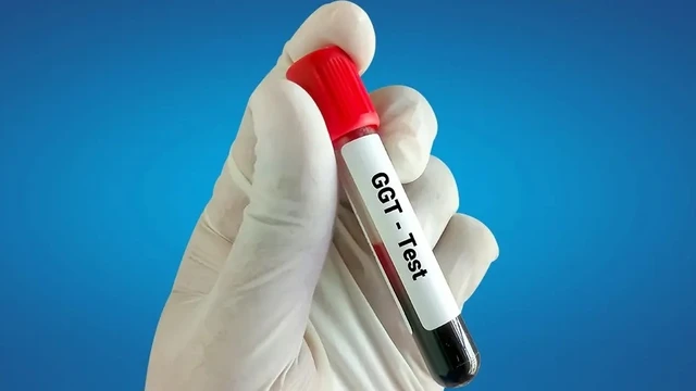 bai-viet/chi-so-ggt-la-gi-va-mot-so-thong-tin-can-biet-ve-chi-so-ggt.html