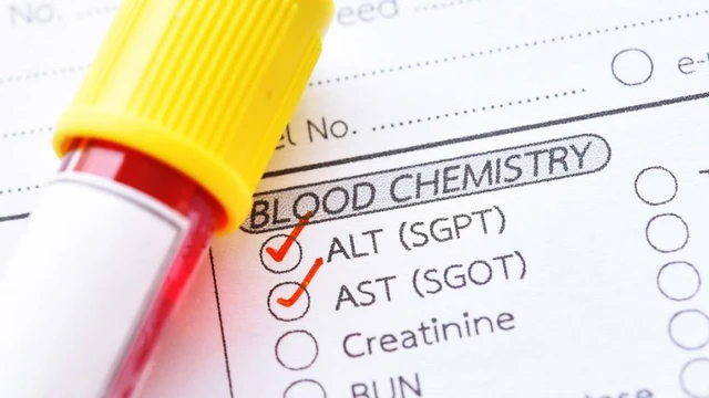 bai-viet/chi-so-got-la-gi-nhung-dieu-ban-can-biet-ve-chi-so-got-69555.html