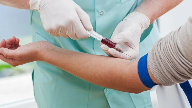 bai-viet/chi-so-mcv-la-gi-co-y-nghia-nhu-the-nao-68882.html