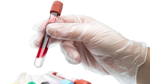 bai-viet/giai-dap-chi-so-wbc-trong-xet-nghiem-mau-la-gi-65152.html