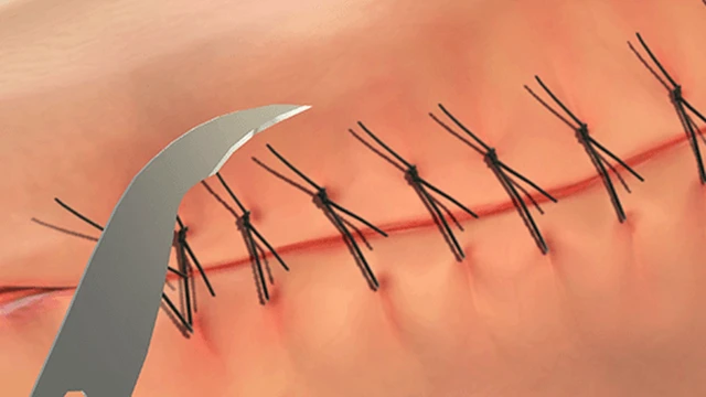 bai-viet/chi-tu-tieu-la-gi-khi-nao-thi-su-dung-chi-tu-tieu-67903.html