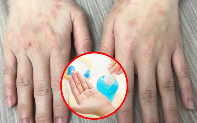 bai-viet/chu-y-lua-chon-dung-va-khong-lam-dung-nuoc-rua-tay-kho-45842.html