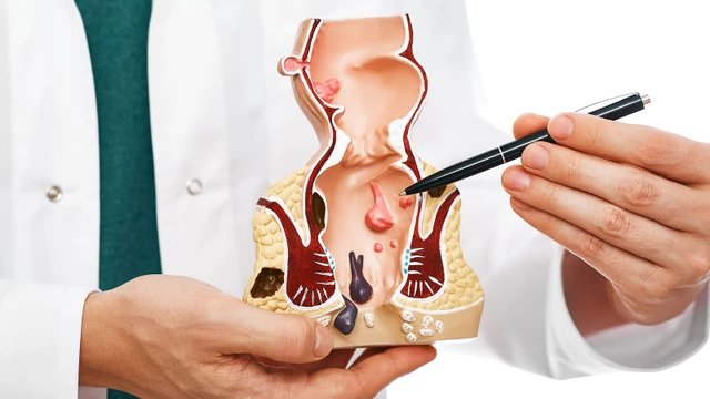 bai-viet/chua-benh-tri-ngoai-khong-can-phau-thuat-va-bien-phap-phong-ngua-benh-tri-ngoai.html