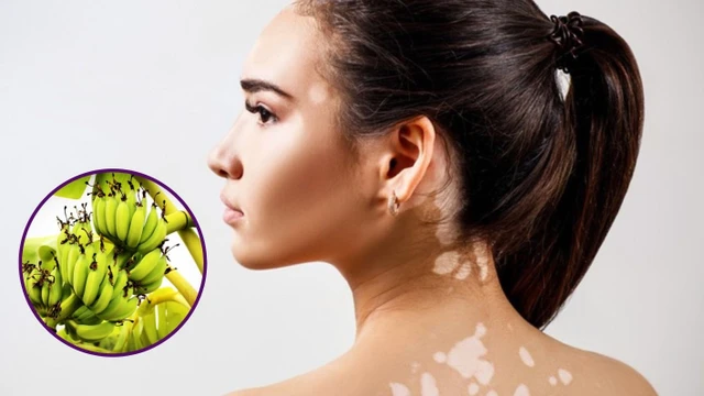 bai-viet/meo-dan-gian-chua-lang-beng-bang-chuoi-xanh.html