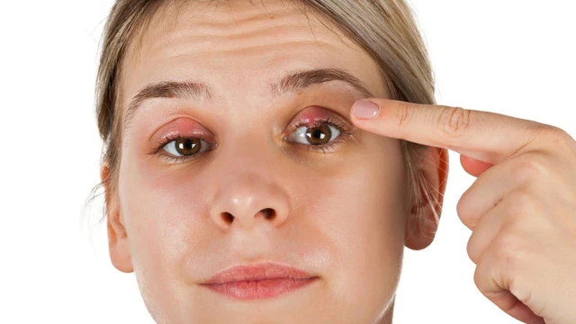 bai-viet/co-nen-chua-leo-mat-bang-nuoc-bot-khong.html