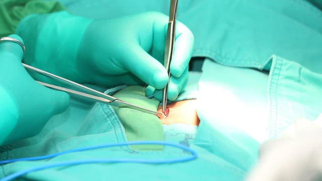 bai-viet/chua-thoat-vi-ben-khong-can-mo-nhung-dieu-can-biet-truoc-khi-lua-chon-phuong-phap-dieu-tri.html