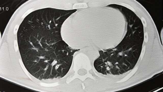 bai-viet/chup-ct-phoi-la-gi-va-khi-nao-can-thuc-hien-chup-ct-phoi.html