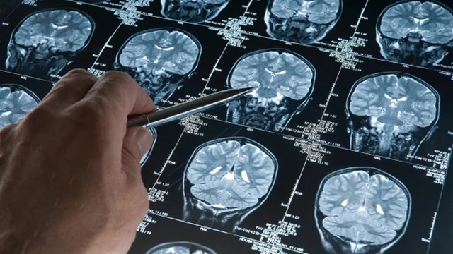 bai-viet/chup-nao-o-benh-vien-nao-tot-nhat-hien-nay.html