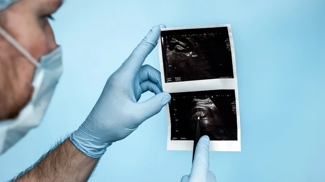 bai-viet/chup-nieu-dao-bang-quang-nguoc-dong-khi-nao-de-lam-gi.html